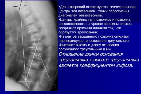 Кракен продажа